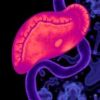 ai-model-identifies-early,-typically-invisible-tissue-changes-indicative-of-pancreatic-cancer