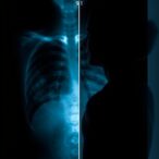 survey-reveals-many-women-prefer-mammograms-at-50,-while-experts-recommend-starting-at-40