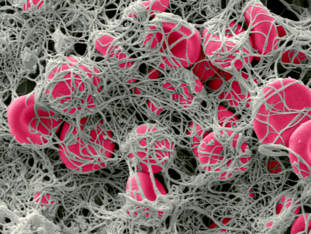 “click-clotting”-technique-rapidly-creates-stronger-blood-clots