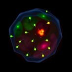 propranolol-blocks-hemangioma-growth-via-neat1-pathway