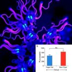 rbm14-boosts-prostate-cancer-by-enhancing-glycolysis