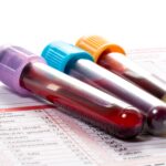 caredx-expands-into-cancer-testing-with-$260m-naveris-buy