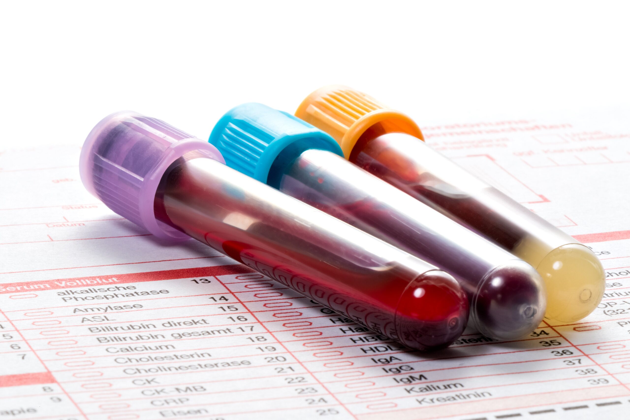 caredx-expands-into-cancer-testing-with-$260m-naveris-buy