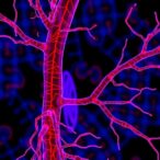 ehmt2-drives-vascular-remodeling-by-repressing-gadd45g