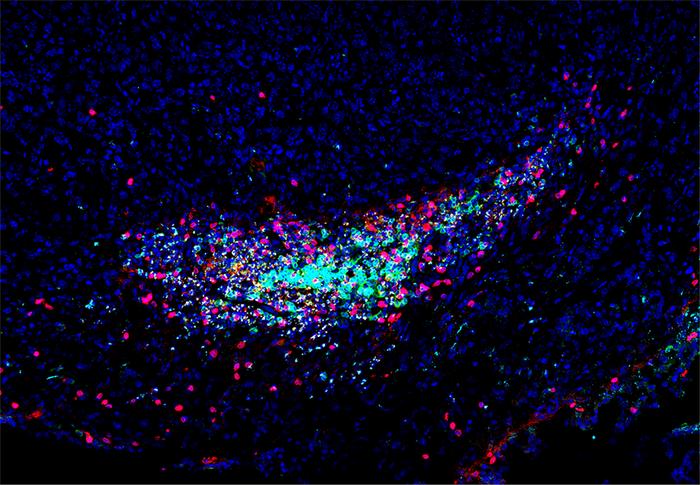 dna-containing-extracellular-vesicles-boost-antitumor-responses-in-mice