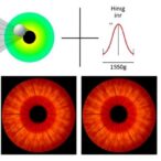 early-detection-of-keratoconus-enhanced-by-light-polarization-and-ai