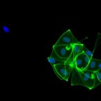 cd44+-monocytes-drive-inflammation-in-preemie-lung-disease