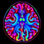 synchrotron-micro-ct-reveals-cns-fluid-spaces-in-vivo