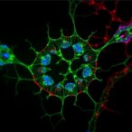 qki-6-and-qki-7-drive-schwann-cell-regeneration