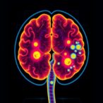 visual-ai-predicts-5-year-survival-in-elderly-prostate-cancer