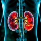 urine-analysis-reveals-kidney-cancer-metabolism-shifts