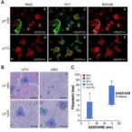 new-study-uncovers-role-of-gadd45b-in-intestinal-ischemia/reperfusion-injury