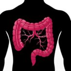 targeting-nudt21-cuts-colorectal-cancer-spread