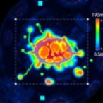 non-invasive-spatial-profiling-of-tumor-microenvironment