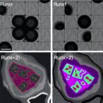 runx1-and-runx2-jointly-suppress-mammary-tumors