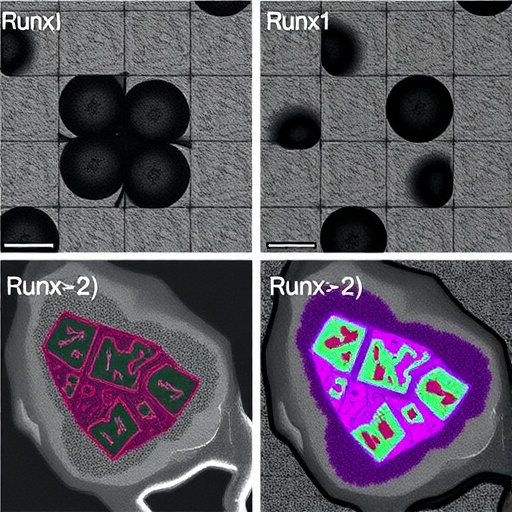 runx1-and-runx2-jointly-suppress-mammary-tumors