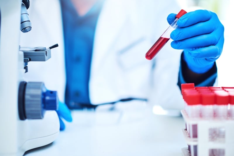new-hepta-blood-test-could-predict-glp-1-response