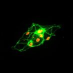 btg2-blocks-fmo1-ufmylation,-worsens-liver-injury