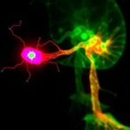 catecholaminergic-neurons-enhance-keloid-fibroblast-bone-growth