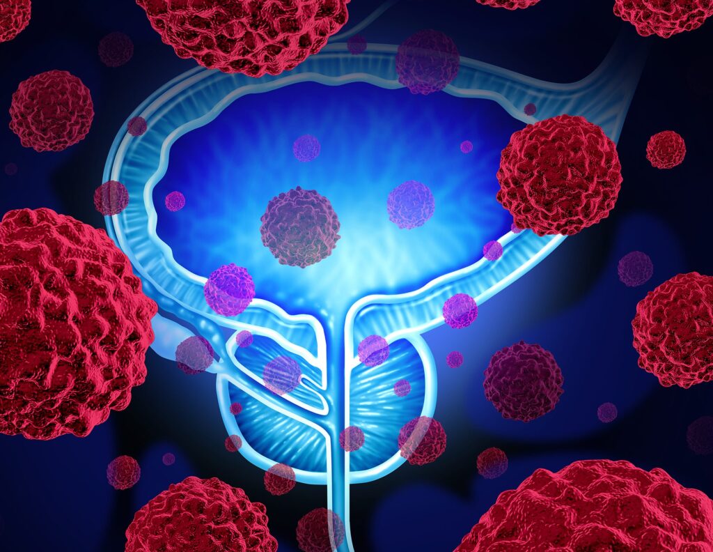 stockwatch:-engene-shares-crater-on-declines-in-complete-response-rates-to-bladder-cancer-therapy