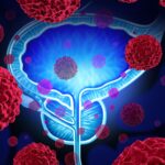 stockwatch:-engene-shares-crater-on-declines-in-complete-response-rates-to-bladder-cancer-therapy