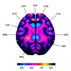 lipid-profiles-in-amygdala:-sporadic-vs-gba-parkinson’s