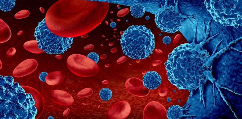 cellares-and-protgen-automate-manufacturing-of-progenitor-t-cell-therapy-for-blood-cancer