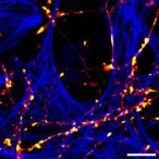 visualizing-receptor-transport-within-neurons-via-transcytosis