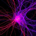 single-cell-map-reveals-immune-shift-in-als