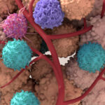 molecular-anchors-help-tumor-therapies-stay-longer-on-cancer-cells