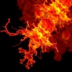 single-cell-atlas-reveals-cd55+-stem-cells’-role-in-atherosclerosis