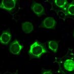 indocyanine-green-fluorescence-differentiates-neuroblastic-tumors