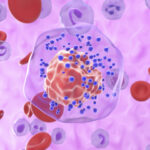rage-implicated-in-worsening-breast-cancer-mortality-with-age