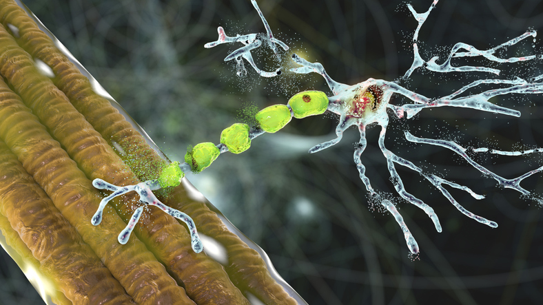multiomic-als-study-links-peripheral-immune-infiltration-to-cns-inflammation
