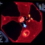 pembrolizumab-and-lenvatinib-trial-for-mucosal-melanoma