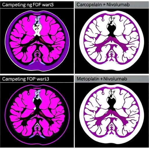 carboplatin-±-nivolumab-in-metastatic-tnbc-trial
