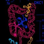 dkc1-drives-colorectal-cancer-via-sphingolipid-disruption