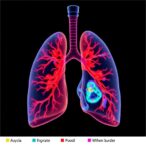 uncovering-copd-subtypes-via-variational-autoencoders