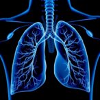 new-alliance-launches-trial-to-explore-targeted-radiation-therapy-following-lung-cancer-surgery