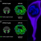 evaluating-apr-246-response-in-ovarian-cancer-mutants
