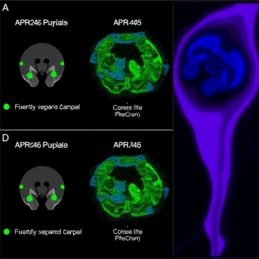 evaluating-apr-246-response-in-ovarian-cancer-mutants