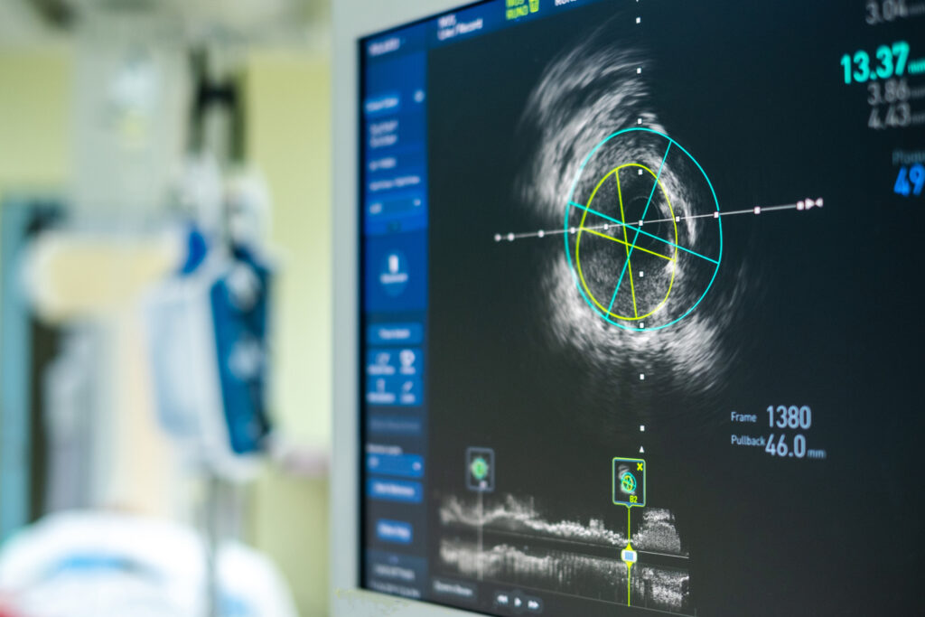 endologix-acquires-thrombectomy-system-from-surmodics