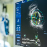 endologix-acquires-thrombectomy-system-from-surmodics