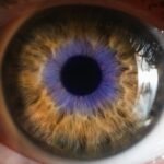 immunovant-pays-out-$39m-to-call-time-on-fcrn-inhibitor-after-eye-disease-phase-3-fails