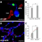 csa+atg-outperforms-csa-alone-in-pediatric-aplasia
