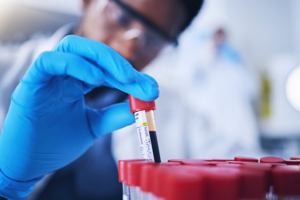 labcorp-joins-lab-results-personalization-push-with-‘mylabcorp’-ai-app
