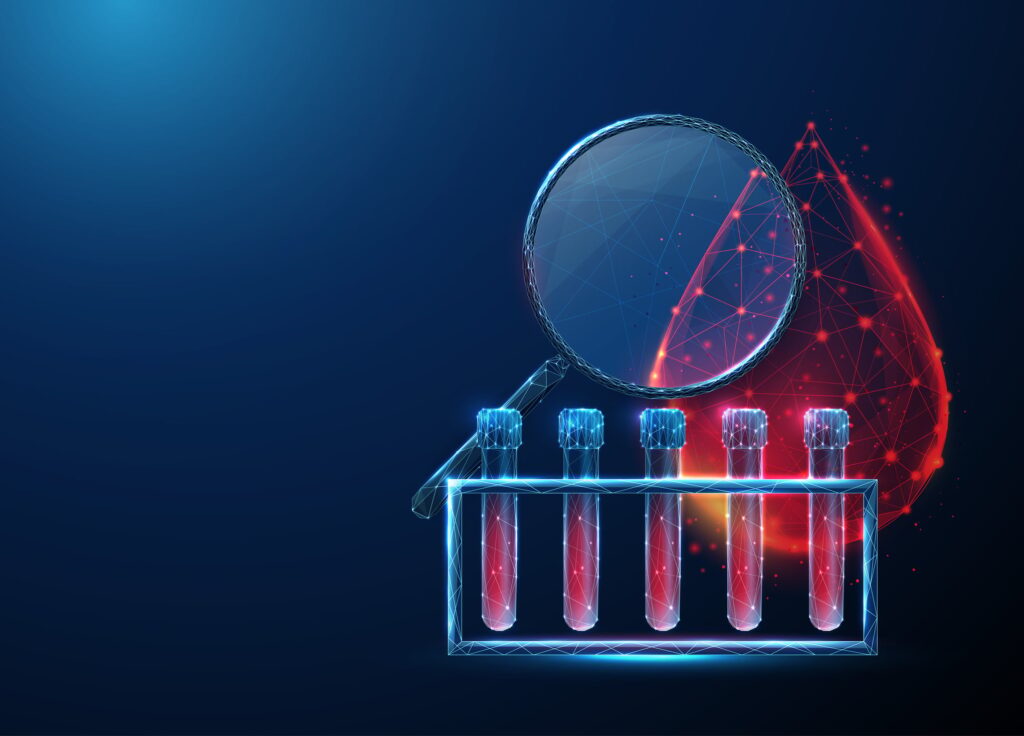 qiagen-links-with-chip-giant-nvidia-to-propel-ai-use-in-drug-discovery