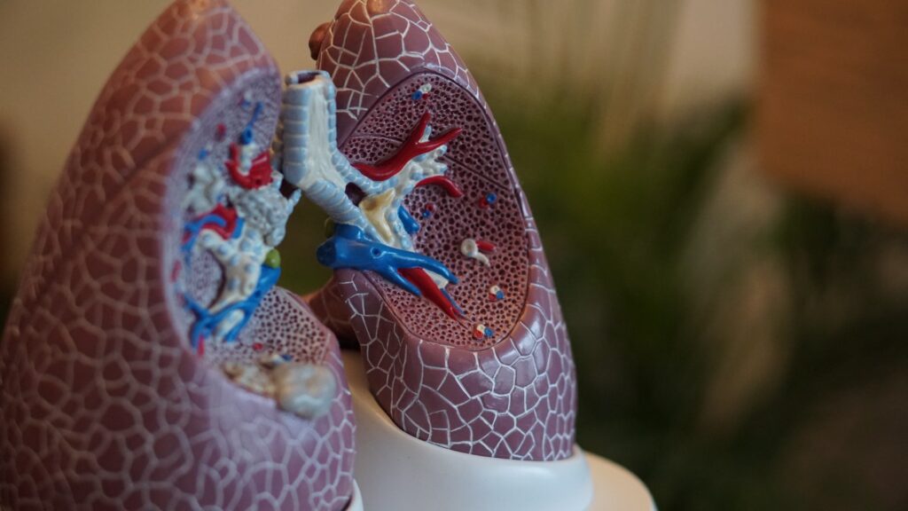 infex,-following-in-insmed’s-footsteps,-advances-lung-disease-candidate-after-clearing-phase-2a