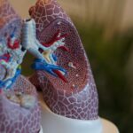 infex,-following-in-insmed’s-footsteps,-advances-lung-disease-candidate-after-clearing-phase-2a