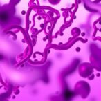 serum-urokinase-differentiates-borderline-her2-cancers